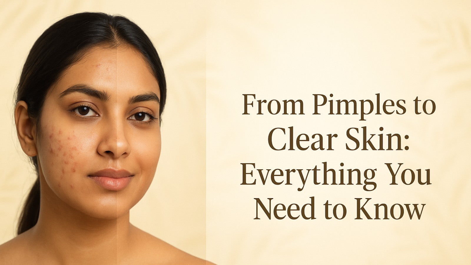 From Pimples to Clear Skin: Everything You Need to Know