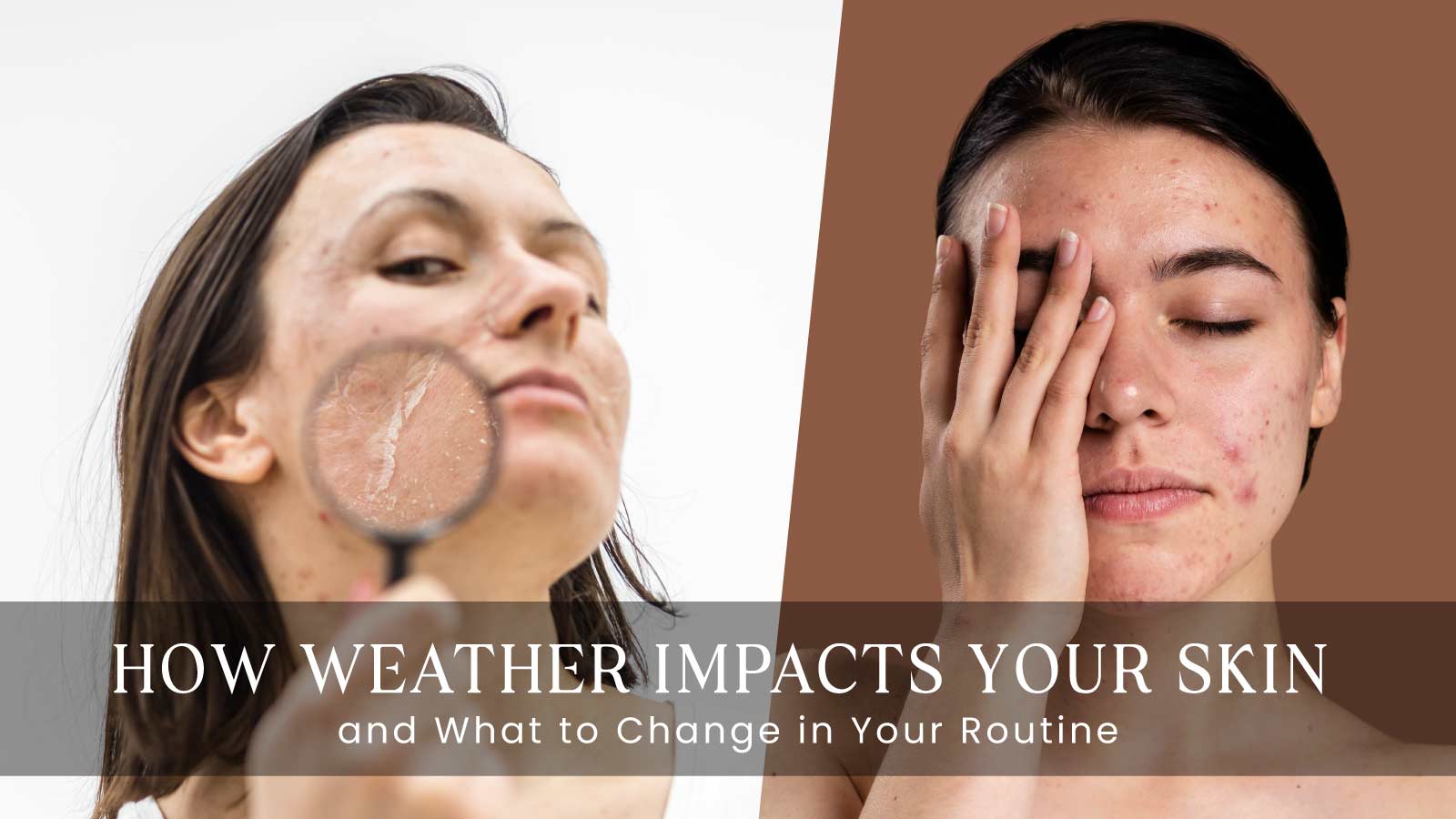 How Weather Impacts Your Skin | Seasonal Skincare Guide by PHIMEDY