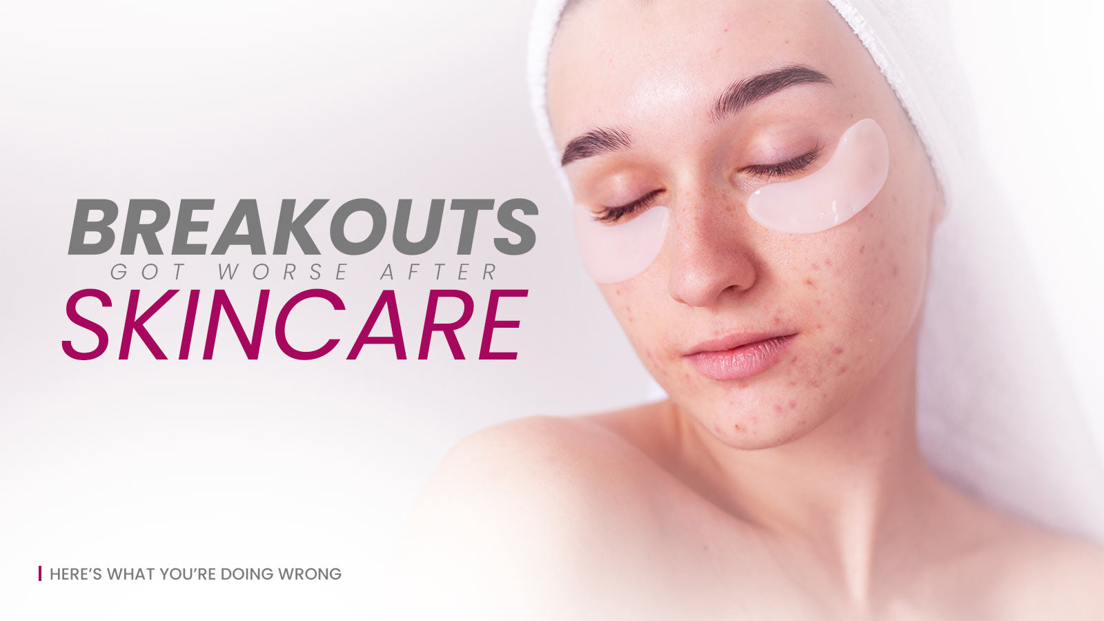 Breakouts Got Worse After Skincare Here’s What You’re Doing Wrong